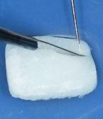 2 Labial flap preparation with a microsurgical