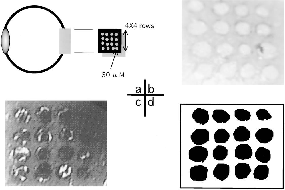The original image obtained using an SLO is shown in Figure 5c, and the processed image of laminar pores obtained by tracing the pore outline by our method (image of laminar pores) is shown in