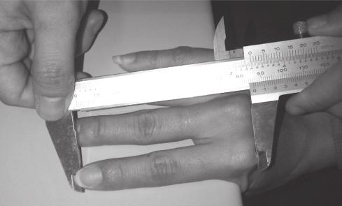 79 Figure 2. Measurement of phalangesû length. B.