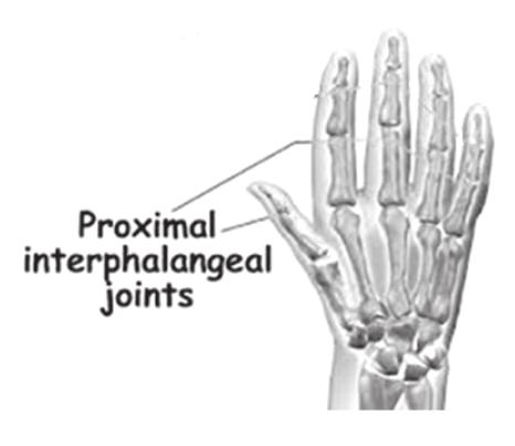 Each 1 st metalparpal phalangeal joint wide. Dependent variable : Sex. Figure 3.