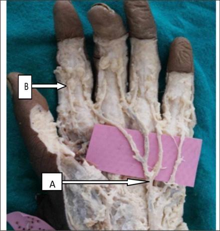 are supplied by superficial palmar arch i.e. by superficial branch of ulnar artery and 2 nd and 4 th web by