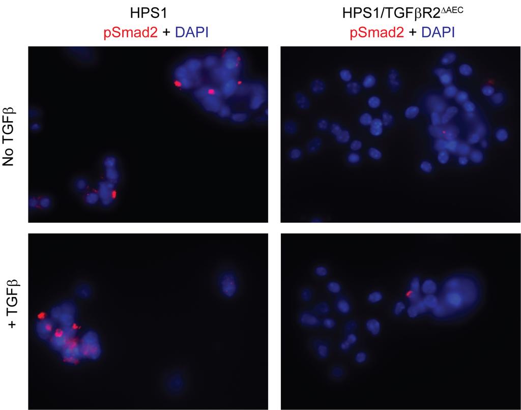 Page 6 Supplemental Figure 5. Reduction in TGFβ signaling in alveolar epithelial cells isolated from HPS1 mice with epithelial deletion of TGFBR2.