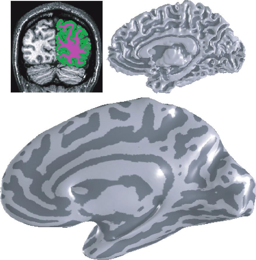 Visul Cortex in Humns 253 c Figure 3 Corticl surfce reconstruction nd visuliztion. () A coronl slice of n ntomicl MRI imge is shown.