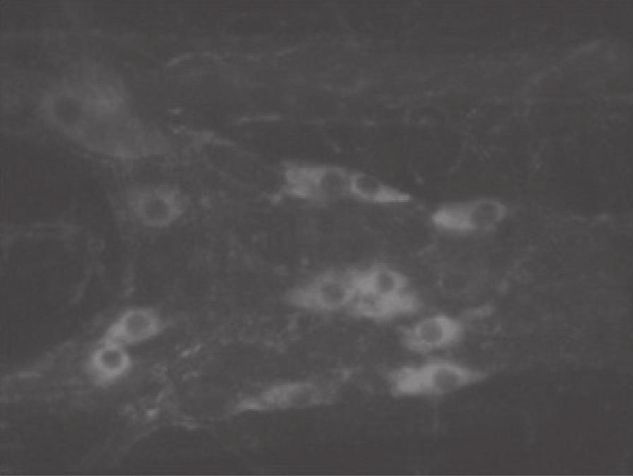 Figure 2. Photomicrography of chagasic proximal colon segment by immunofluorescence polarized light and increase of 40x showing increase of cholinergic neuronal cell body.