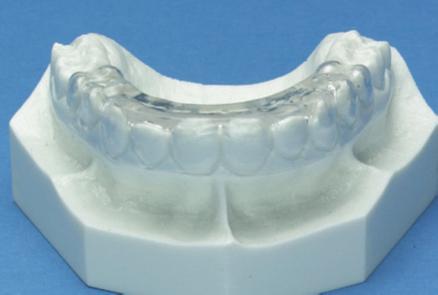 anterior bite plate, 1mm full occlusal coverage Cuspid to cuspid contacts No guidance Open enough for no interferences during function Anterior tooth sensitivity No facial coverage Isofolan