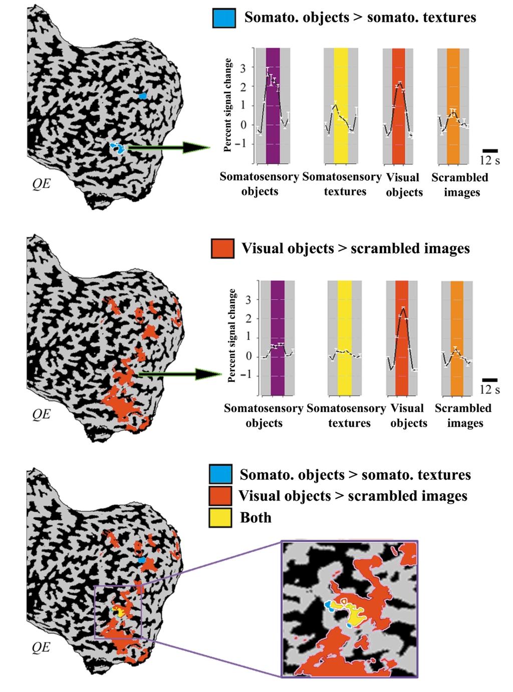 Fig. 3. Cortical maps and time course of regions showing preferential somatosensory, visual and multimodal (visuohaptic) object activation in one subject (QE).