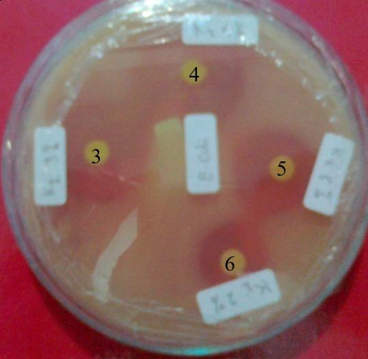 8 Then phenolic flavonoid which is a structure containing a carbonyl group also supports the antibacterial properties of the extract.