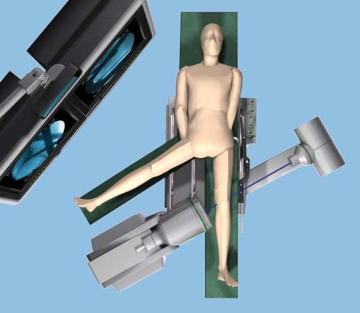 Preparation for Use of the SureLock Targeting Device continued 3 Position C-arm for distal locking Move the C-arm distally, toward the end