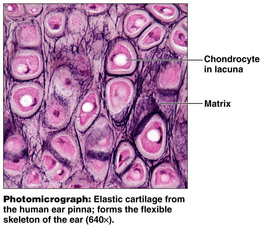 Elastic Cartilage Description Similar to hyaline cartilage, but more elastic fibers in the matrix