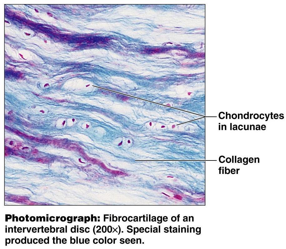 Fibrocartilage Description Found in areas of high stress Matrix similar to but less firm that hyaline; thick collagen fibers predominate Avascular Function Tensile