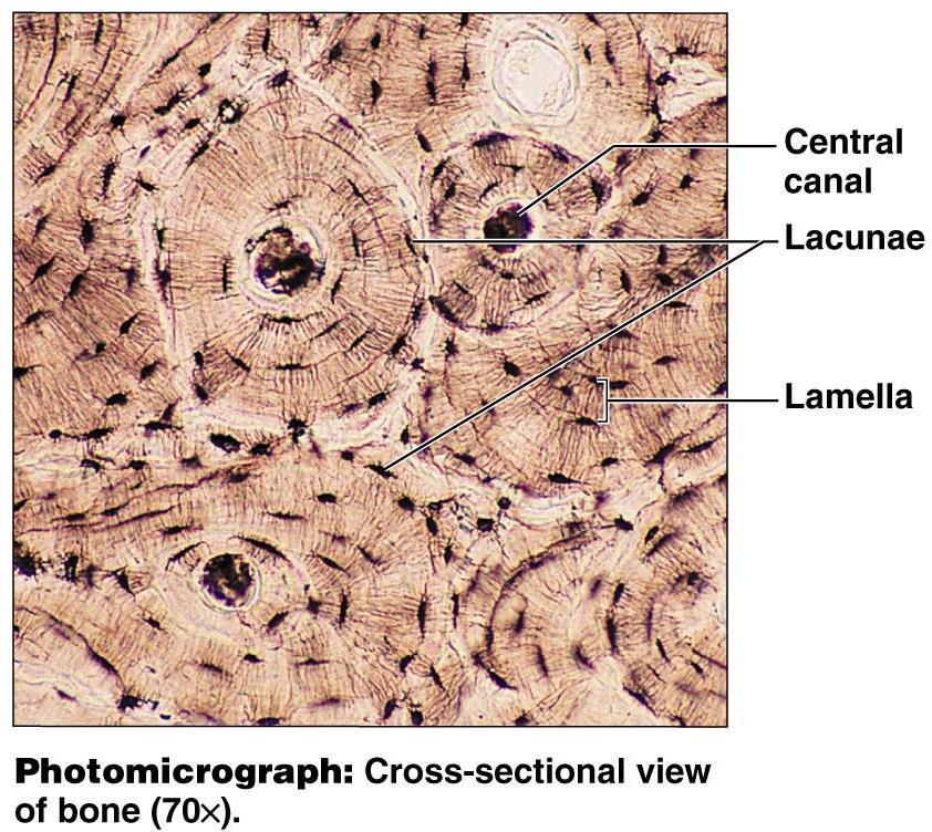 Bone Description Hard, calcified matrix contain many collagen fibers; osteocytes lie in lacunae Highly vascularized Function