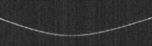 Normal Pulmonary Fissures on MDCT C E G Fig. 2 Sagittal multiplanar reconstruction (MPR) images of phantom minor fissure.