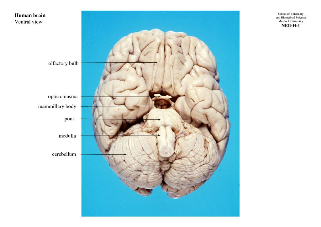 A Ventral Perspective The orbitofrontal cortex Lateral
