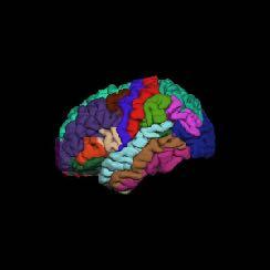 that link determined areas in the brain and compare