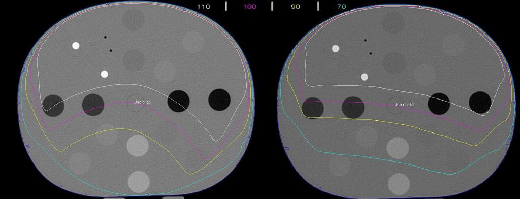 interests for a 2 cgy IBL CBCT (left) and a 5 cgy TBL CBCT (right). Fig. 3.