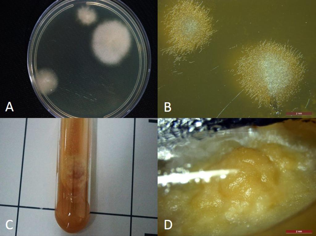 A B C D Figure 3. The morphologies of P. insidiosum cultured in a petri dish (A, B) and a tube (C, D) containing potato dextrose agar.