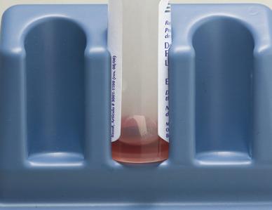 Use the Loop to stir the blood sample in the Developer Solution ( Solution ) (see picture B9).