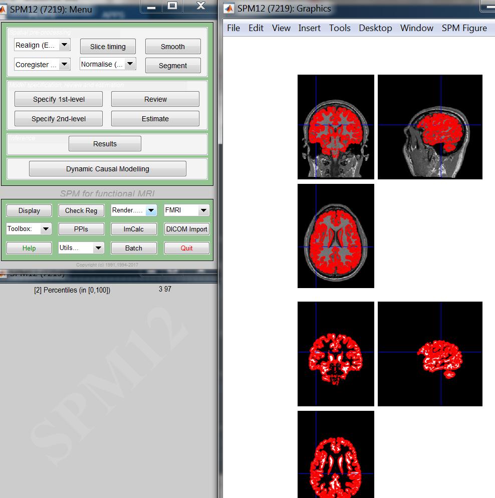 Brain and Tissue Accuracy in