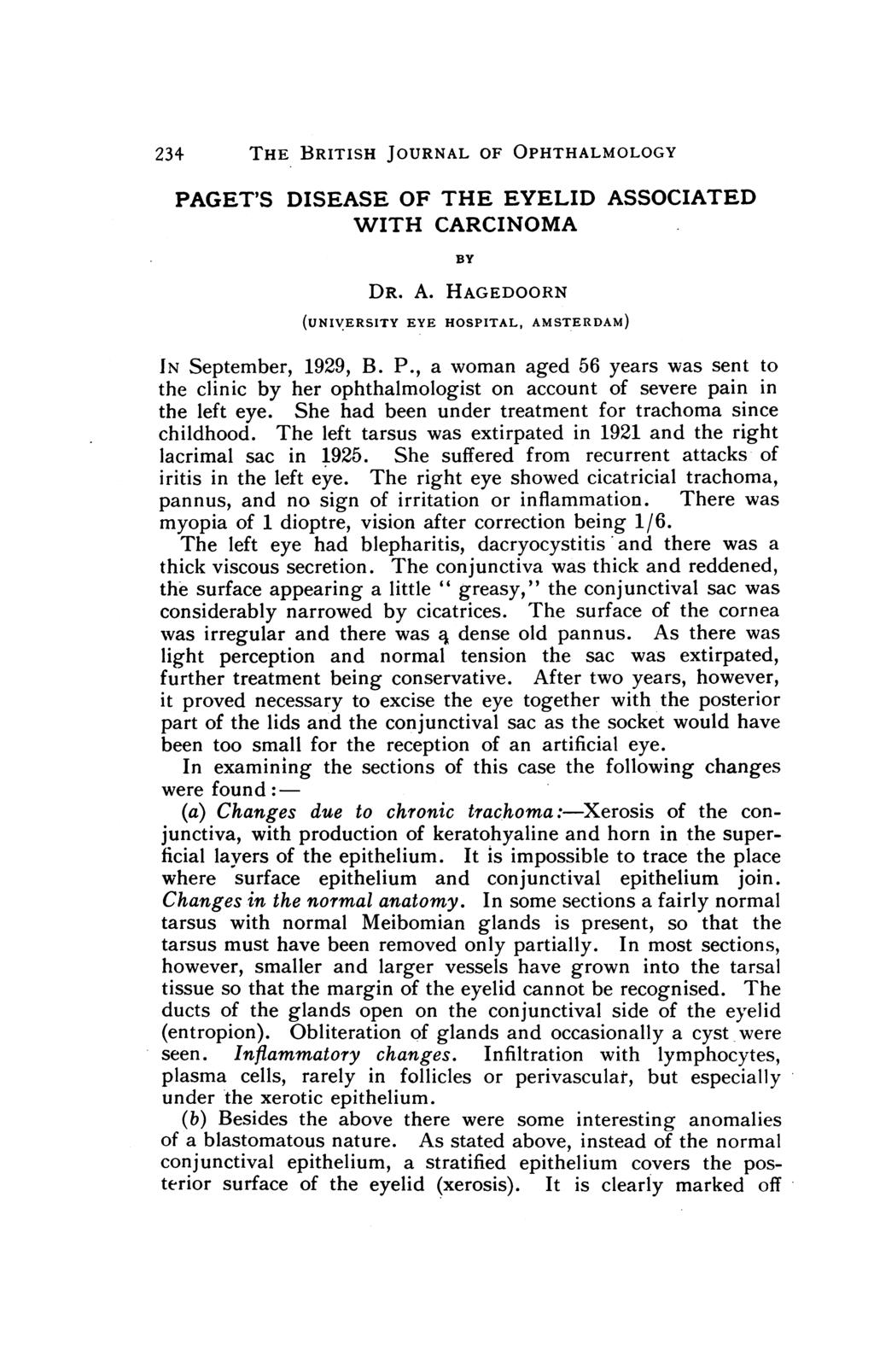 234 THE BRITISH JOURNAL OF OPHTHALMOLOGY PAGET'S DISEASE OF THE EYELID ASSOCIATED WITH CARCINOMA BY DR. A. HAGEDOORN (UNIVERSITY EYE HOSPITAL, AMSTERDAM) IN September, 1929, B. P., a woman aged 56 years was sent to the clinic by her ophthalmologist on account of severe pain in the left eye.