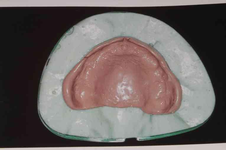 Prosthodontics Head