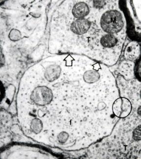 Histological Methods Electron Microscopy A