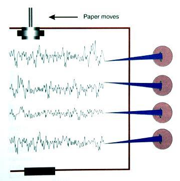 Recording and Stimulating Neural Activity Recording with Macroelectrodes Recording the activity of a region of the brain as a whole, not the activity of individual neurons.