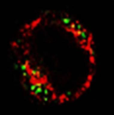 knockdown Jurkt T-cells, nd mesurements of the ER mitochondri interfce (N, nucleus; M, mitochondrion; E,