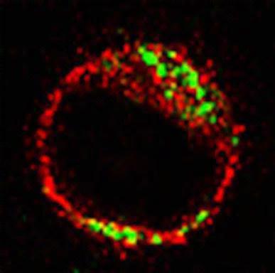 () Confocl microscopy nlysis of the colocliztion of ER (red) nd mitochondri (green). Scle rs, 1 μm.