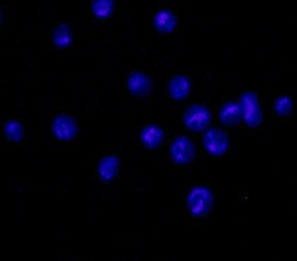 () Mitochondril memrne potentil ws visulized with epifluorescence