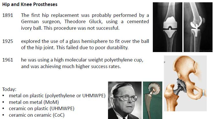 PMMA This material was used to fabricate intraocular lenses (and first hard contact lenses) > 7million IOL applications today worldwide 13 14 Evolution of Biomaterials 1st generation biomaterials