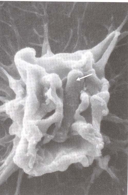 Electron micrograph showing the membrane ruffling induced by
