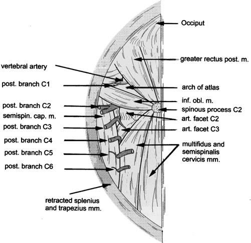 Spasmodic torticollis FIG. 2. Schematic anatomical drawing of posterior (post.) branches of C1 6 on the left side.