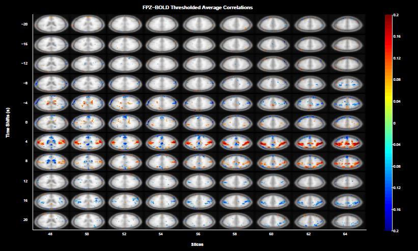 DC EEG-MRI Correlation