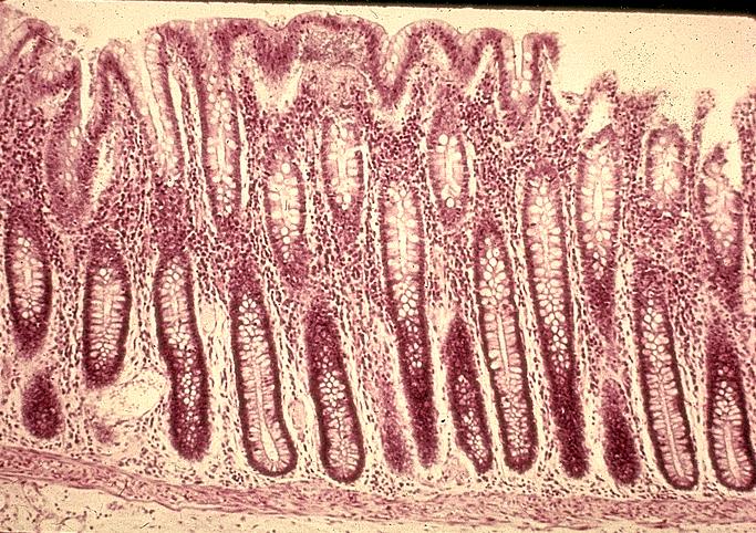MICROSCOPIC ANATOMY OF COLON The mucosa is relatively smooth as compared with that of the small intestine. There are no villi. Tubular pits or glands are present.