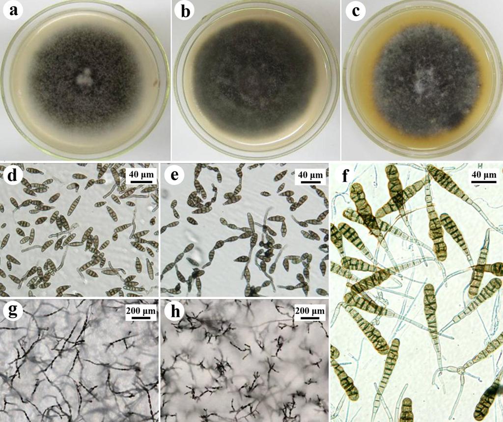 2.1 Morphological traits observation Fig. 2 Colony and microscopic morphologies of Alternaria species a-c:colonies of A.