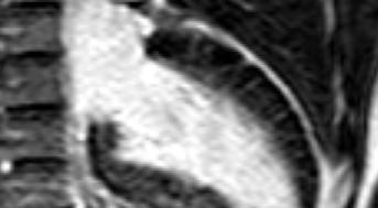 artery Cine MRI