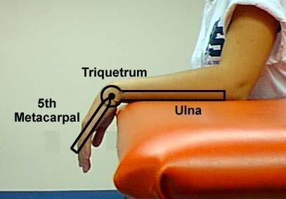 Goniometry Wrist Flexion: Pt seated with forearm resting on table (use