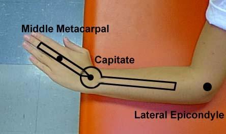 Wrist Radial Deviation: Pt seated with forearm on table Wrist