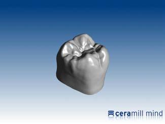 TEMPLATE CAD & OCCLUSION Dynamic occlusal contouring using the Ceramill Artex to avoid occlusal