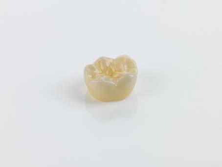 _Fabricate fully anatomical zircon oxide restorations highly efficiently in your own laboratory