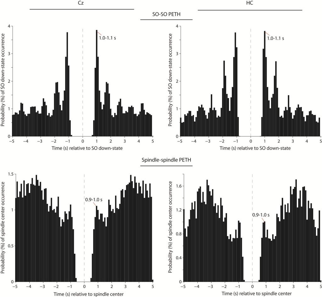 Supplementary Figure 3 Peri-event time histograms (PETH).