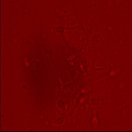 Binding of NP-mannose with human spermatozoa in presence of mannose Human spermatozoa samples were stained with a slight modification of the reported procedure 2. NP-mannose (0.