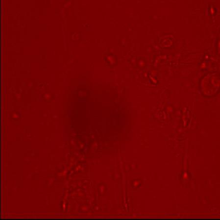 5 mm), CaCl 2 (20 mm) and bovine serum albumin (1%, w/v) in the presence of various amount of mannose monosaccharide. Spermatozoa were then pipetted on glass sides and fixed on cover glass.