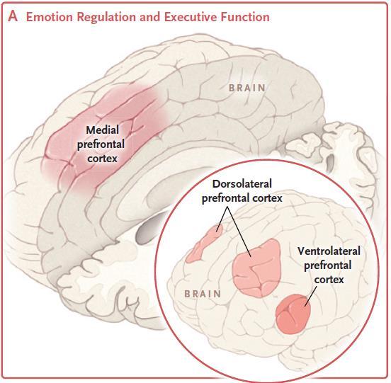 Emotion Regulation and Executive Function: Impaired executive function and emotion regulation may underlie memory and concentration deficits, poorly controlled emotional responses, irritability, and