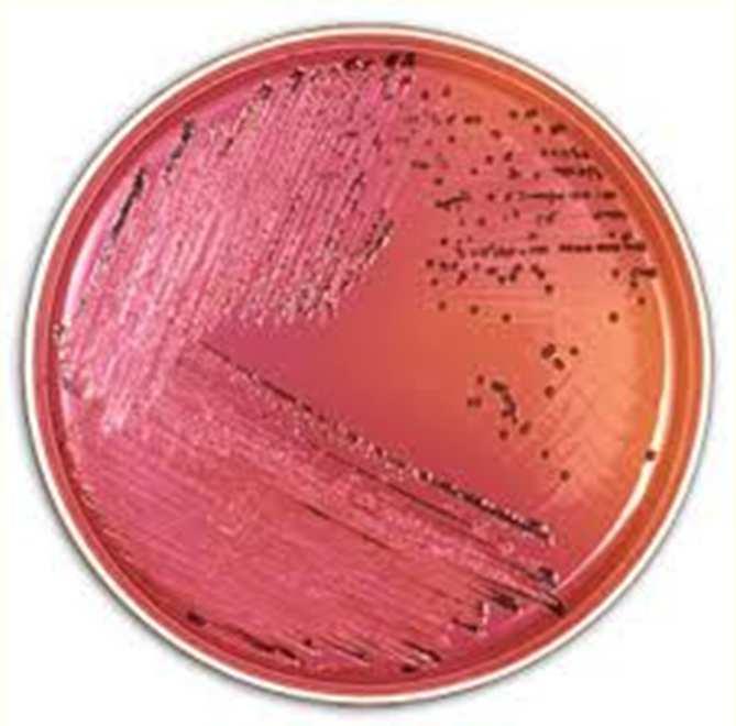 Microbiological Analysis o Pathogenic micro-organisms Bacillus cereus Clostridium perfringens Escherichia