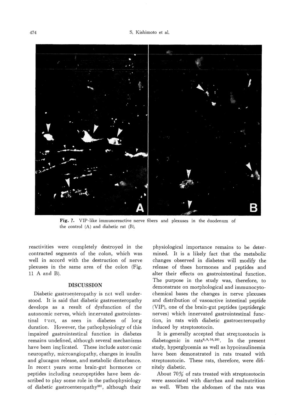 474 S. Kishimoto et al. Fig. 7. VIP-like immunoreactive nerve fibers and plexuses in the duodenum of the control (A) and diabetic rat (B).