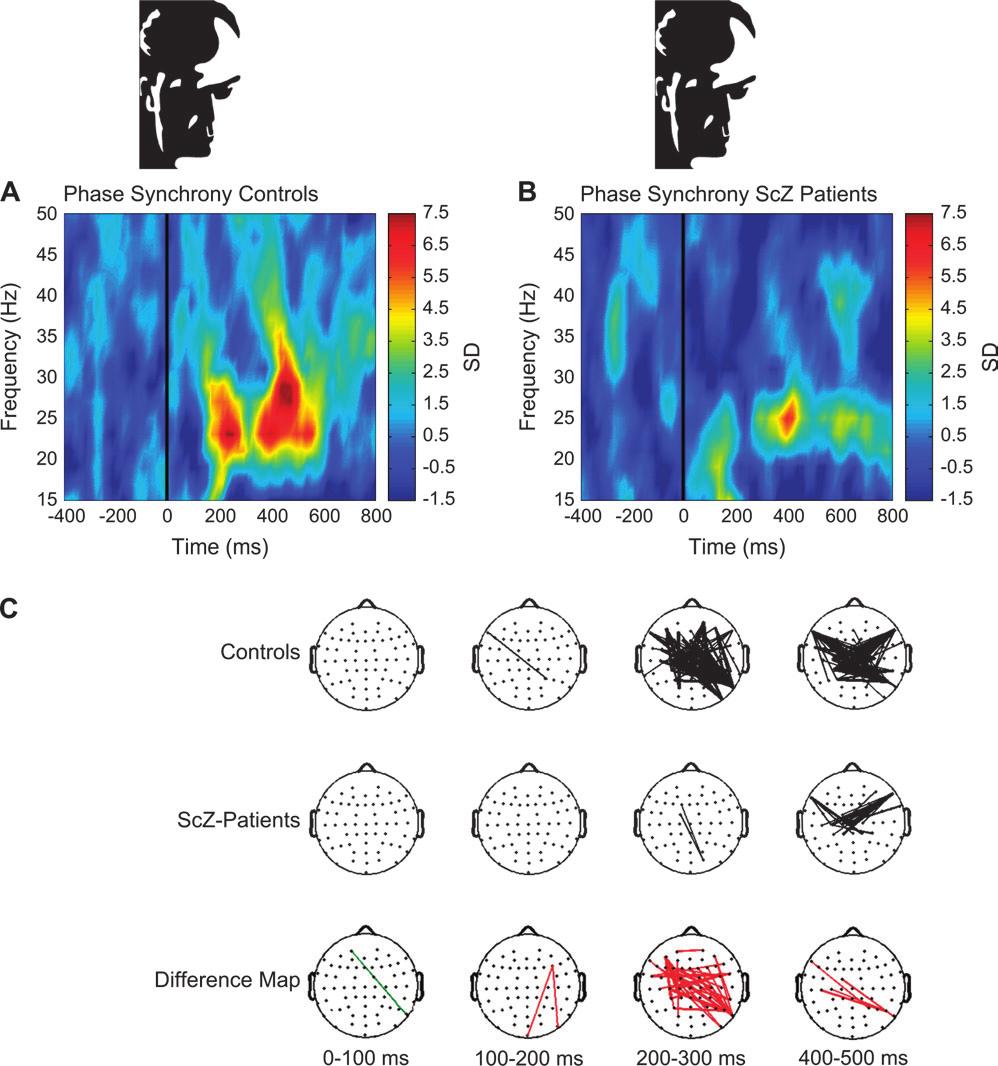 P. J. Uhlhaas et al. Fig. 2. Neural Synchrony During Gestalt Perception in Schizophrenia.
