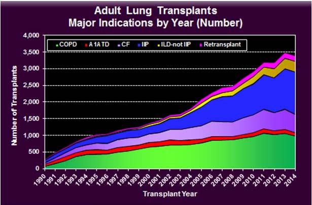 Lung Transplantation The only therapy that prolongs survival in IPF IPF is now