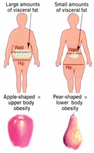 Assesment of Obesity The amount of body fat is difficult to measure directly, and is usually determined from an indirect measure the body mass index (BMI) that has been shown to correlate with the
