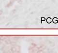 PCGEM1 may play an oncogenic role in prostate cancer.